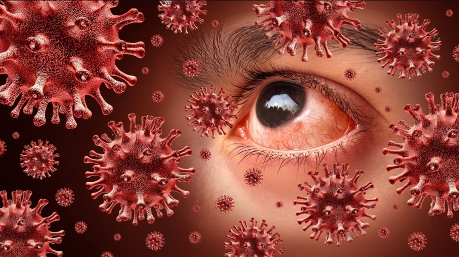 Pink Eye Conjunctivitis